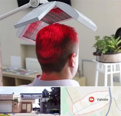 کاشت مو با لیزر در وحیدیه شهریار