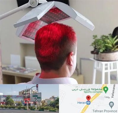 کاشت مو با لیزر در هروی 