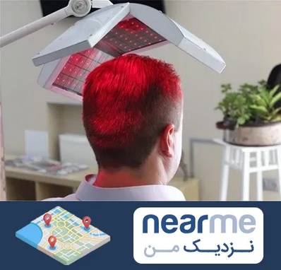 کاشت مو با لیزر در نزدیک من