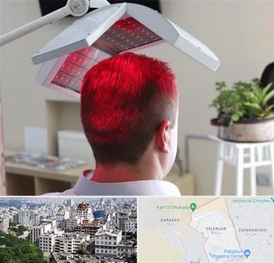 کاشت مو با لیزر در ولنجک 