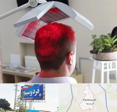 کاشت مو با لیزر در فردوسیه شهریار