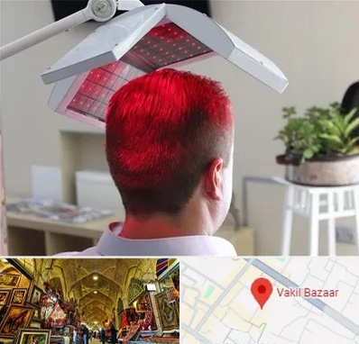 کاشت مو با لیزر در بازار وکیل شیراز