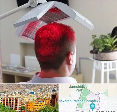 کاشت مو با لیزر در نیاوران 