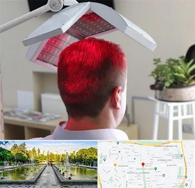 کاشت مو با لیزر در سرسبز 