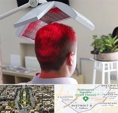 کاشت مو با لیزر در نارمک 