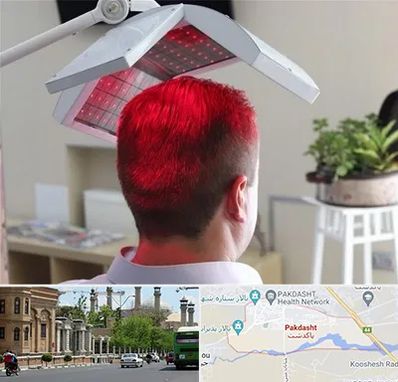 کاشت مو با لیزر در پاکدشت