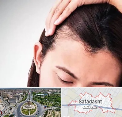 کاشت مو بانوان در صفادشت