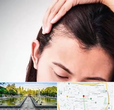 کاشت مو بانوان در سرسبز 