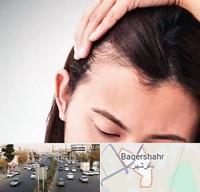 کاشت مو بانوان در باقرشهر