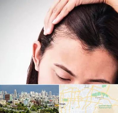 کاشت مو بانوان در شرق تهران 