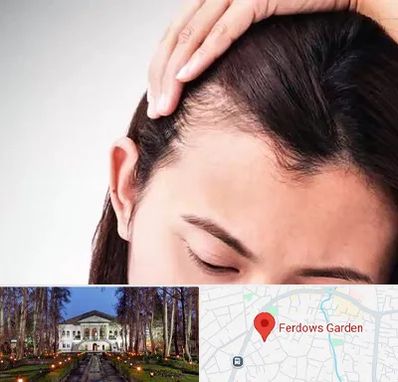 کاشت مو بانوان در باغ فردوس