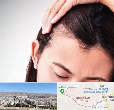 کاشت مو بانوان در شهرک گلستان شیراز