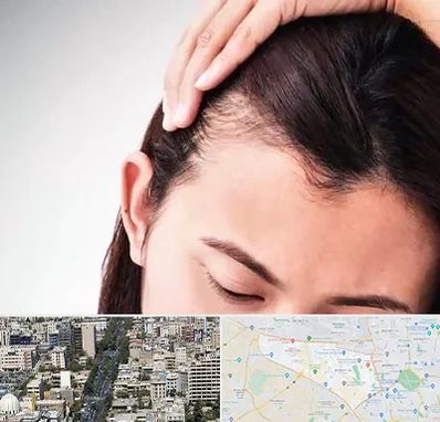 کاشت مو بانوان در منطقه 18 تهران 