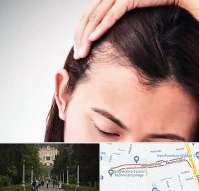 کاشت مو بانوان در بلوار معلم رشت 