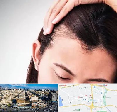 کاشت مو بانوان در شهرک راه آهن