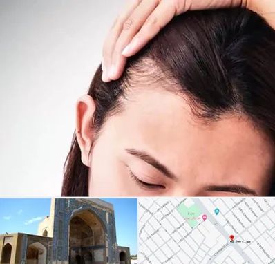 کاشت مو بانوان در مصلی مشهد