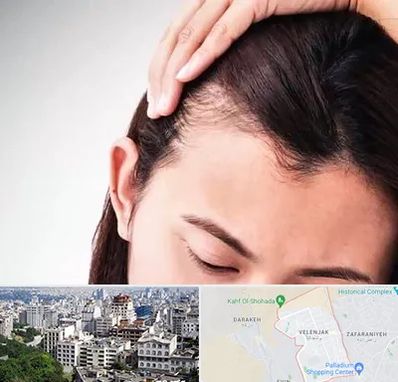 کاشت مو بانوان در ولنجک 