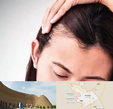 کاشت مو بانوان در سیرجان