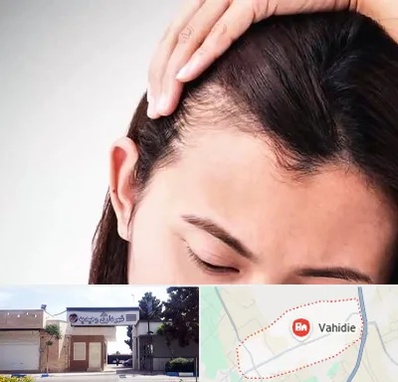 کاشت مو بانوان در وحیدیه شهریار