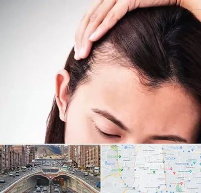 کاشت مو بانوان در منطقه 10 تهران 