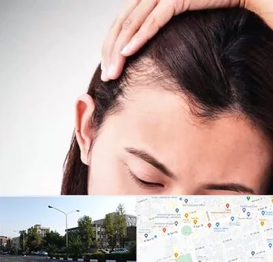 کاشت مو بانوان در میدان کاج 