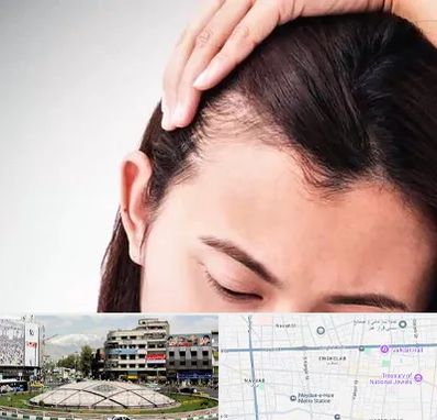 کاشت مو بانوان در مرکز تهران