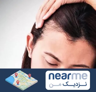 کاشت مو بانوان در نزدیک من