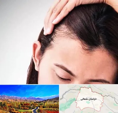 کاشت مو بانوان در خراسان شمالی