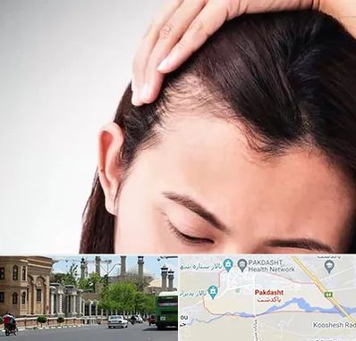 کاشت مو بانوان در پاکدشت