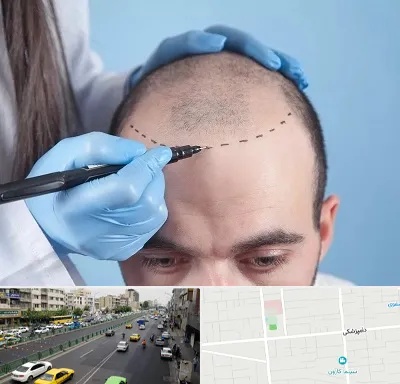 کاشت مو اقساطی در خیابان دامپزشکی