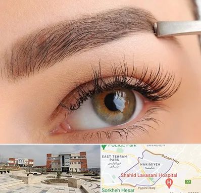 کاشت ابرو اقساطی در حکیمیه 