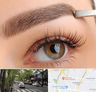 کاشت ابرو اقساطی در ظفر 