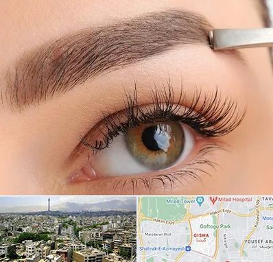کاشت ابرو اقساطی در گیشا 