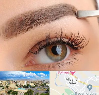 کاشت ابرو اقساطی در میانه