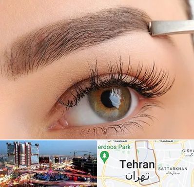 کاشت ابرو اقساطی در صادقیه 