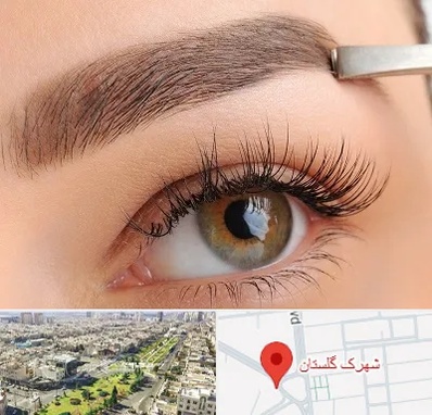 کاشت ابرو اقساطی در شهرک گلستان