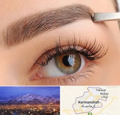 کاشت ابرو اقساطی در کرمانشاه