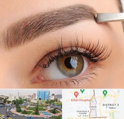 کاشت ابرو اقساطی در ونک 