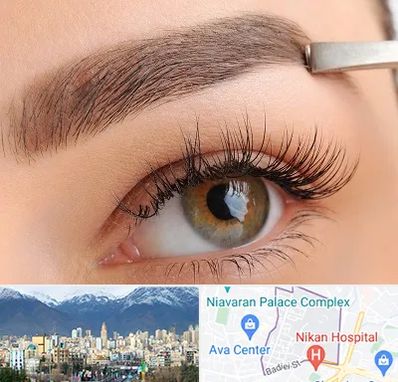 کاشت ابرو اقساطی در آجودانیه 