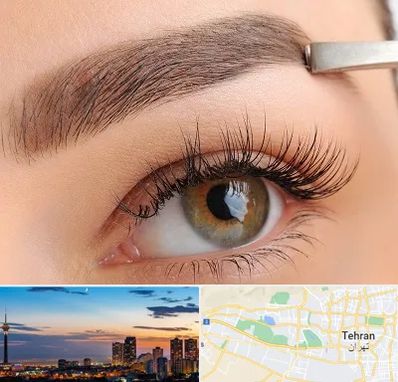 کاشت ابرو اقساطی در غرب تهران 