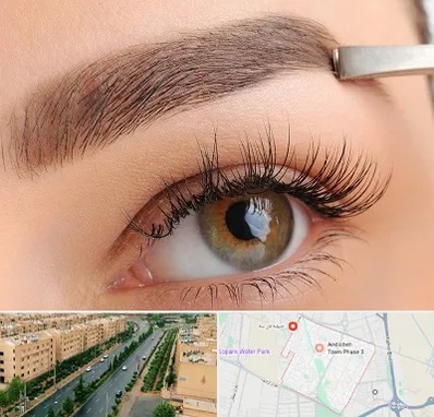 کاشت ابرو اقساطی در فاز سه اندیشه
