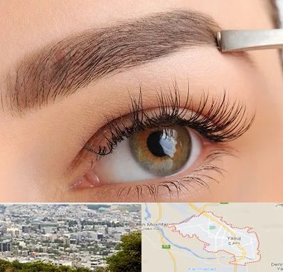 کاشت ابرو اقساطی در یاسوج