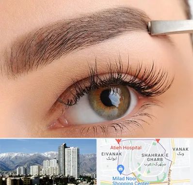 کاشت ابرو اقساطی در شهرک غرب 