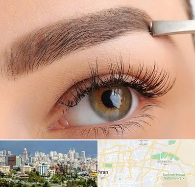 کاشت ابرو اقساطی در شرق تهران 