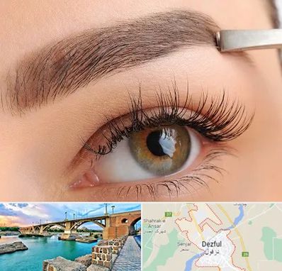 کاشت ابرو اقساطی در دزفول