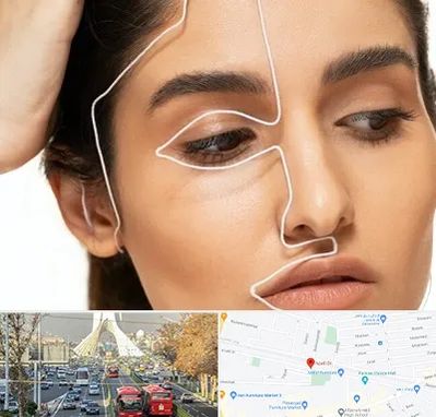 عمل بینی اقساطی در خیابان آزادی 