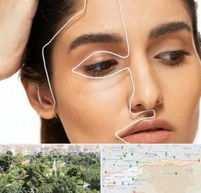 عمل بینی اقساطی در منطقه 13 تهران 