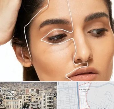 عمل بینی اقساطی در اسکندری