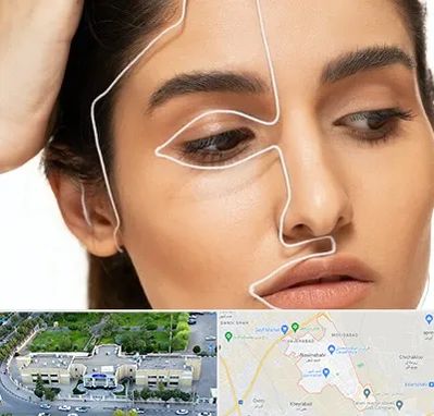 عمل بینی اقساطی در نسیم شهر