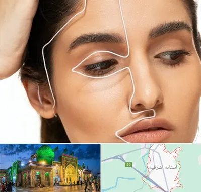 عمل بینی اقساطی در آستانه اشرفیه